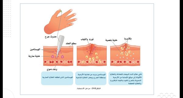 ⁦المناعة الطبيعية⁩ - الصورة ⁦5⁩