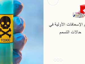 تقديم الإسعافات الأولية في حالات التسمم