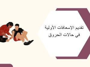تقديم الإسعافات الأولية في حالات الحروق