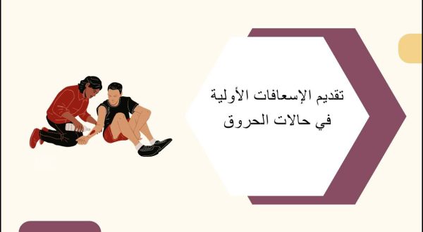 تقديم الإسعافات الأولية في حالات الحروق